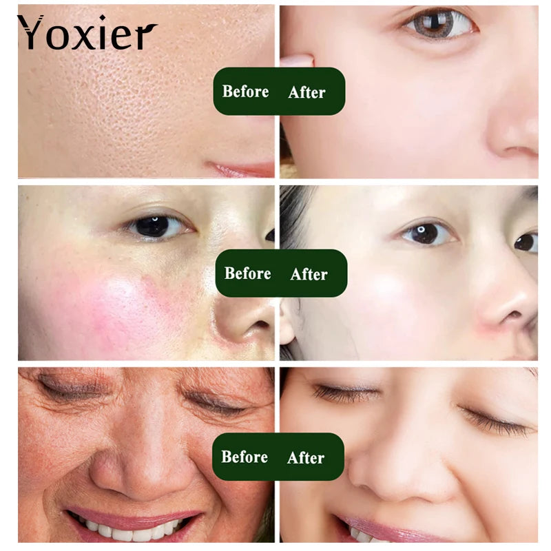 Anti-Aging Snails Concentrate Face Care Hyaluronic Acid Moisturizing Oil-Control Serum Snail Pure Extract Face Care 10Ml